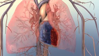 Right-Sided Heart Failure