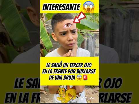 Por burlarse de una bruja le salió un tercer ojo en la frente 😱🧙‍♀️👀interesante asombroso🚨😱