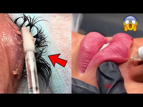 Most Extreme Beauty Treatments 2025 Best Smart and Helpful Beauty Hacks | Virtual Beauty