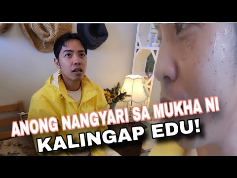 KALINGAP EDU ANONG NANGYARI SA MUKHA MO! SCHOOLAR NG EDCY TULOY PA BA SA PAG-AARAL! Kalingap RAB