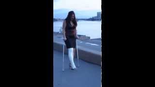 long leg cast crutching girl