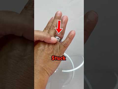 How To Remove A Ring 😨