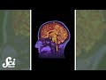 Understanding Brain Fingerprints