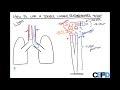 Understanding Double Lumen Endotracheal Tubes