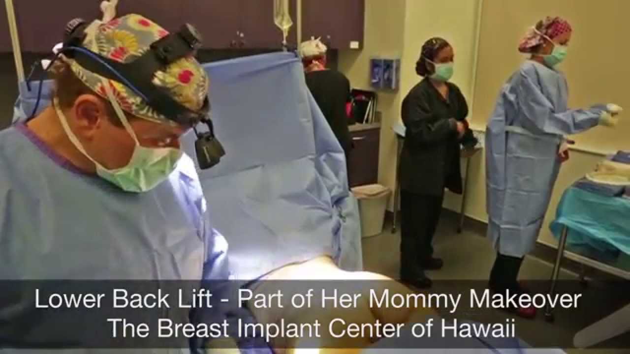 Butt Lift - Lower Back Lift (Graphic). Surgery After Weight Loss - Mommy Makeover Hawaii