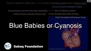 Blue Babies or Cyanosis