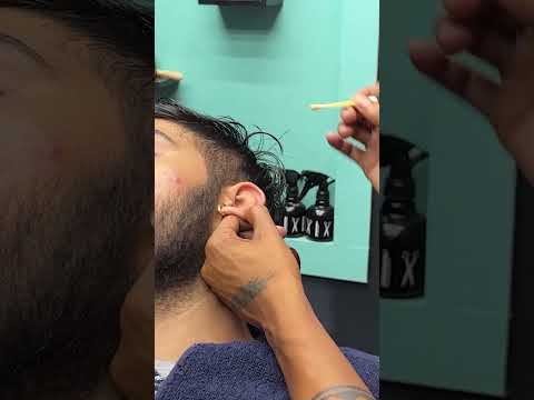 Nasty Wax Removal and Ear Cleaning W. Peroxide💈#asmr #shorts #earwaxremoval