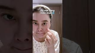 Mình đã MỔ MẮT - Review chi tiết mổ mắt PHAKIC