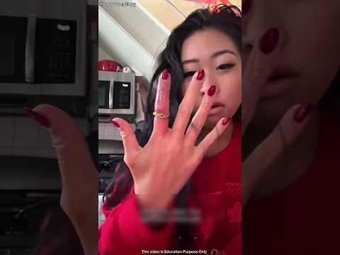 Dangerous Ring Problem You Must See 😨 #shortsvideos (Credit - @babydumplingg)