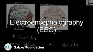 Electroencephalography(EEG)