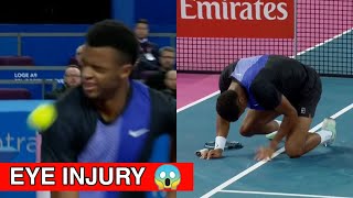 Mpetshi Perricard Hits Ball in Eye | Perricard Eye Injury Montpellier