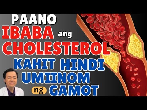 Paano Ibaba ang Cholesterol ng Walang Iniinom na Gamot - By Doc Willie Ong