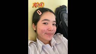 💖ជាស្អាតម្នាក់ទៀតហើយ😍ប្អូនស្រីជាអតិថិជនរបស់មជ្ឈមណ្ឌលត្រីក្រហម តំណាងខាងខេត្ត​ បាត់ដំបង🏥