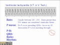 Ventricular Tachycardia Concepts