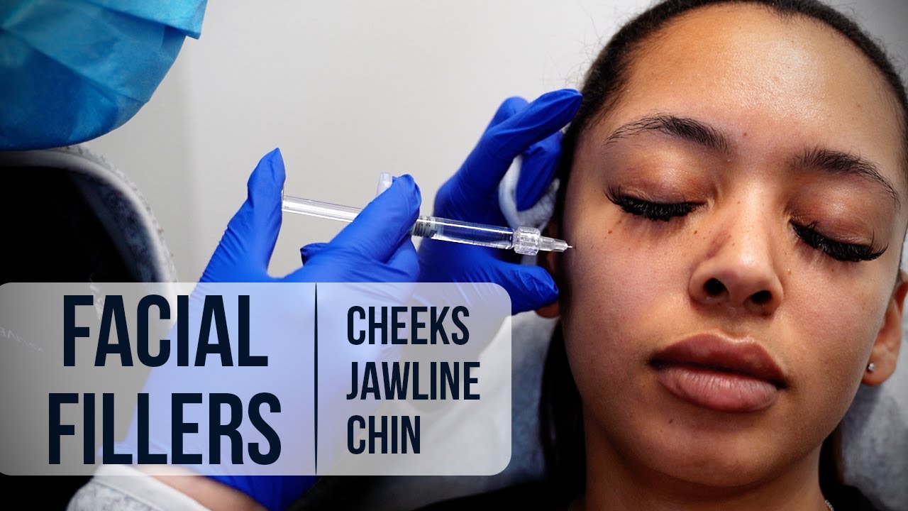 Facial filler treatment for aesthetic enhancements