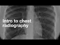 Chest Radiograph Interpretation Questions