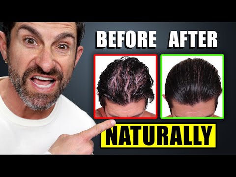 13 Ways to Regrow Hair & Prevent Hair Loss (NATURALLY)