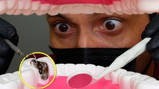 Amazing Dentist And The Tooth Pain | Satisfying Indirect Tooth Restoration
