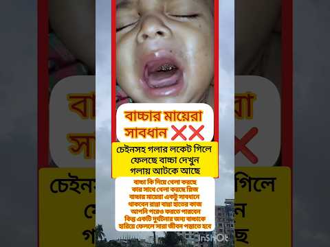 বাচ্চার মায়েরা সাবধান❌❌ #shortsfeed #youtubeshorts #ytshorts #tranding #foryou