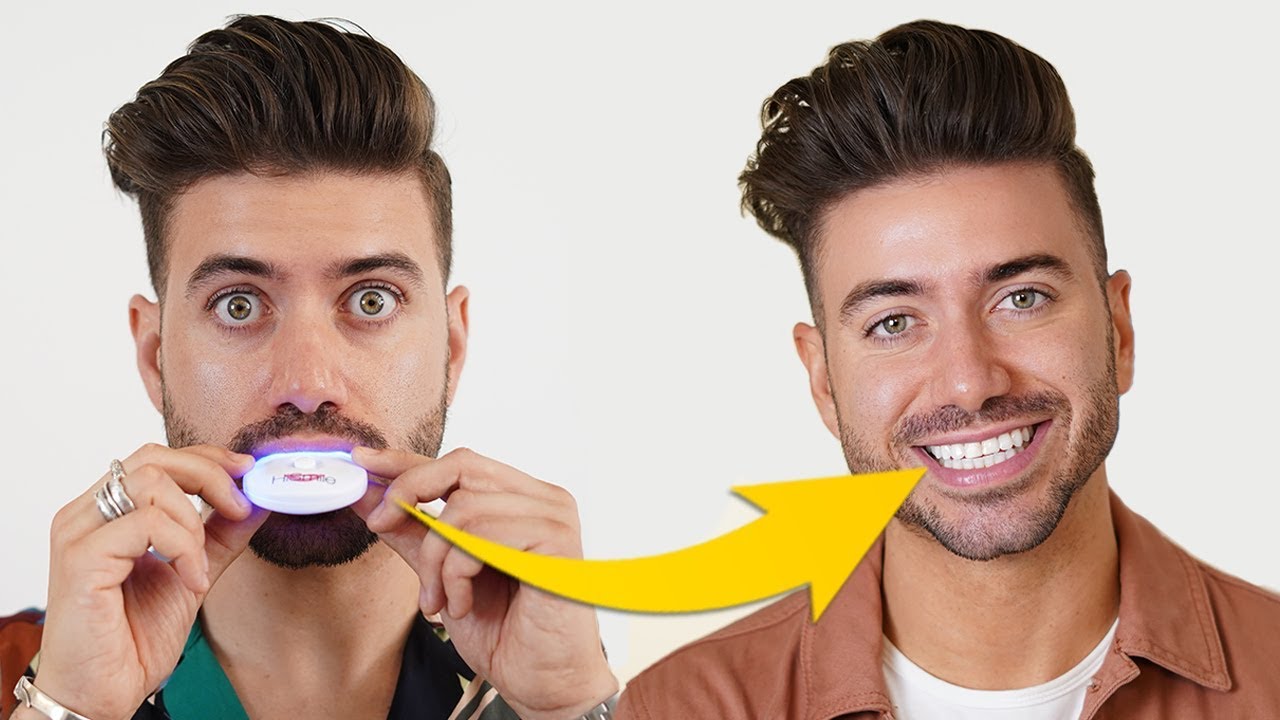 How To Whiten Teeth FAST (100% Works) - Alex Costa
