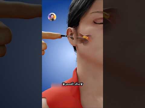 أحذر من استخدام القطن لتنظيف الاذن😖
