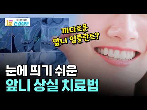 눈에 띄기 쉬운 앞니 상실, 효과적인 치료법은? [🏥1분 건강정보]