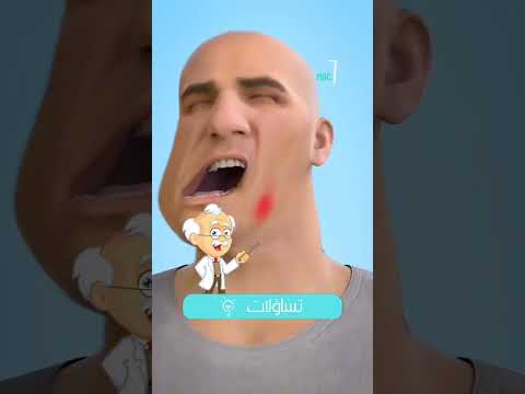عملية إزالة الرصاصة من الجسم قديما
