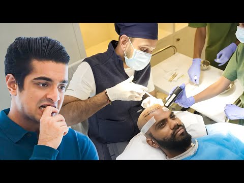 Hair Transplant Full Procedure Live (No Clickbait)
