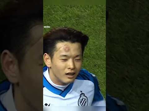 Kok bisa?? Kepalanya Benjol Setelah Mencetak Goal