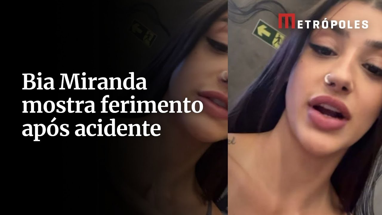 Bia Miranda mostra ferimento após acidente