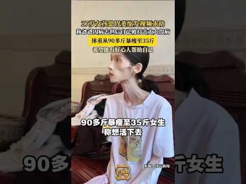🤍 27岁女孩患胃萎缩发视频求助 称爸爸因病去世后自己被打击太大得病 体重从90多斤暴瘦至35斤 希望能有好心人帮助自己 “当命运将她推向深渊，她仍用尽全力，向光而行。” 🤍 #爱与希望