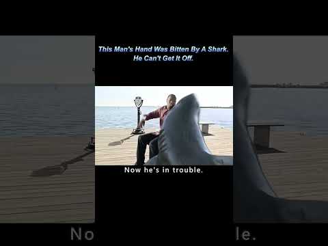 This Man's Hand Was Bitten By A Shark.He Can't Get It Off.