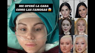 Me operé la cara como los famosos 😱