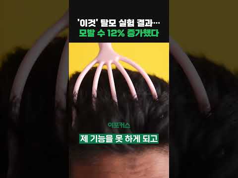 '이것' 탈모 실험 결과..모발 수 12% 증가했다