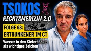 Folge 68: Ertrunkener im CT – Wasser in den Kieferhöhlen als wichtiges Zeichen