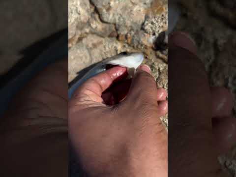 وجود قملت البحر جوه نخشوش السمكه 💀😳😮