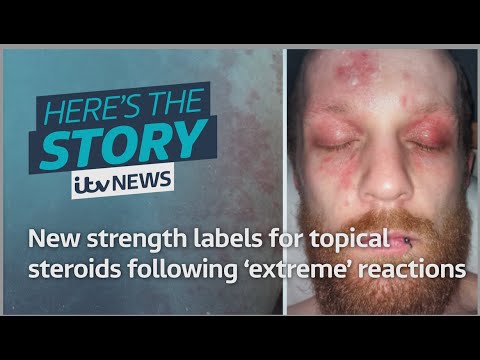 New strength labels for topical steroids following 'extreme' reactions | ITV News