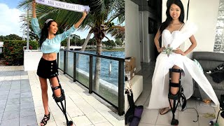 Injured Miss Florida Contestant Uses ‘Pirate Leg’ at Pageant