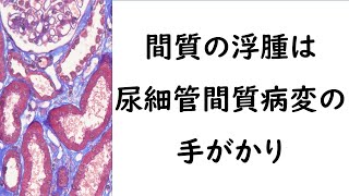 間質の浮腫は大事な所見