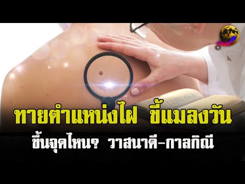 ทายตำแหน่งไฝขี้แมลงวัน ขึ้นตรงไหน? บอกลักษณะวาสนาดี/กาลกิณี