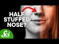 Understanding the Nasal Cycle