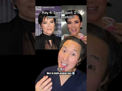 How Does Kris Jenner Look So Incredibly Young? Plastic Surgeon Breakdown!
