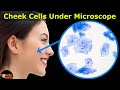Human Cheek Cell Experiment
