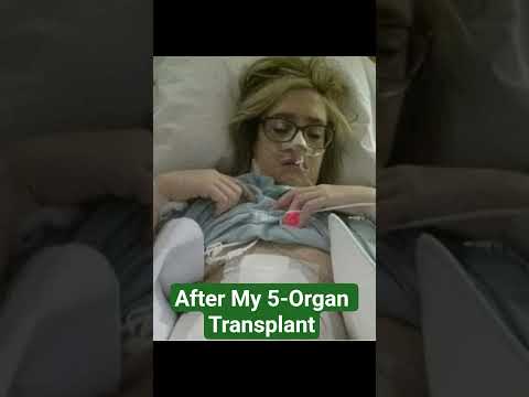 Give me a chance #kidney #transplant #hospital #chronicillness #organtransplant #organ