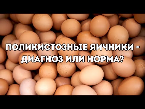 Поликистозные яичники - норма или заболевание? #поликистоз #женскоездоровье #doctorberezovska