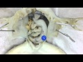 Frog Anatomy and Physiology