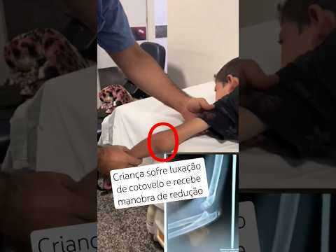 LUXAÇÃO DE COTOVELO: Sintomas, Tratamento e Recuperação Rápida #shorts #youtubechannel #viralbrasil