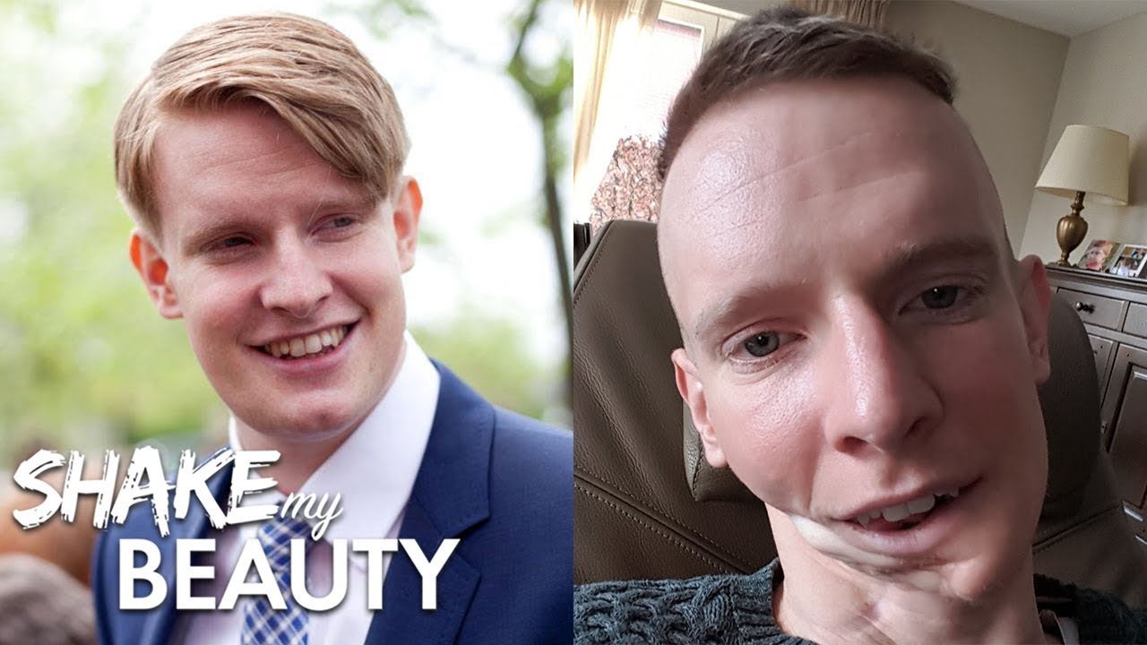 Cancer ate my jaw away - shake my beauty