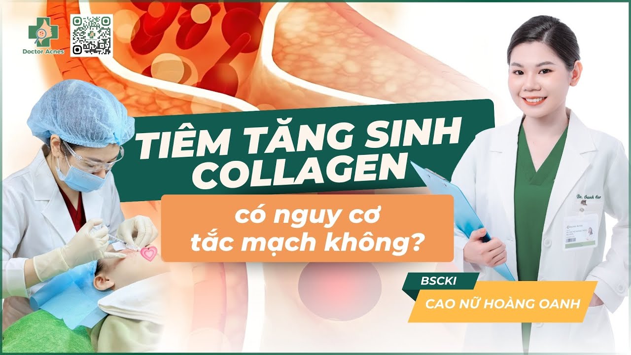 Cấy mỡ thái dương: bí quyết cải thiện gương mặt hóp và thiếu cân đối 2