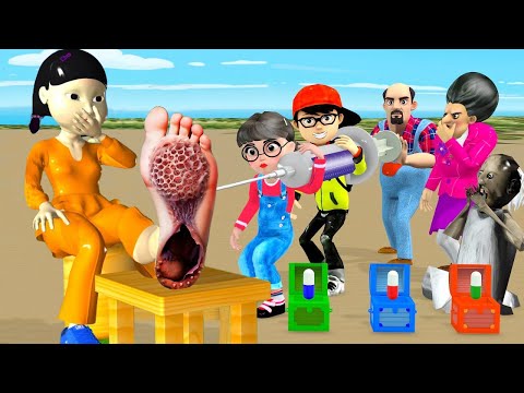 Scary Teacher 3D vs Squid Game Become Doctor Game cure Patients and 5 Time Challenge